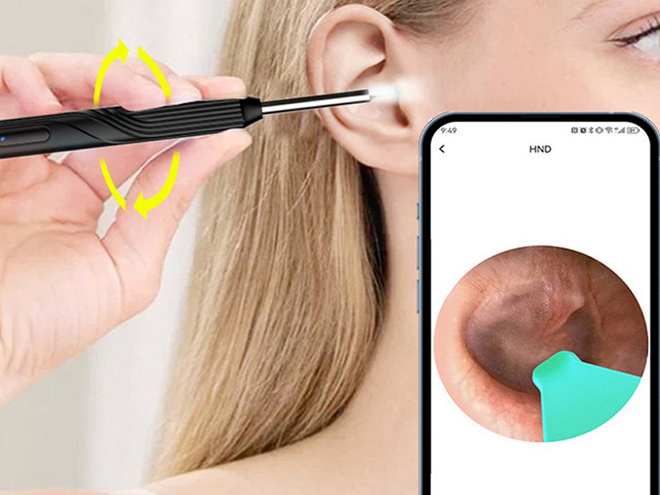 WiFi Otoscope Ear Wax Remover with Camera