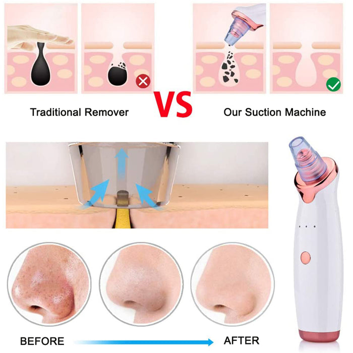 5 Nozzle Facial Blackhead Remover Pore Cleaner- USB Charging