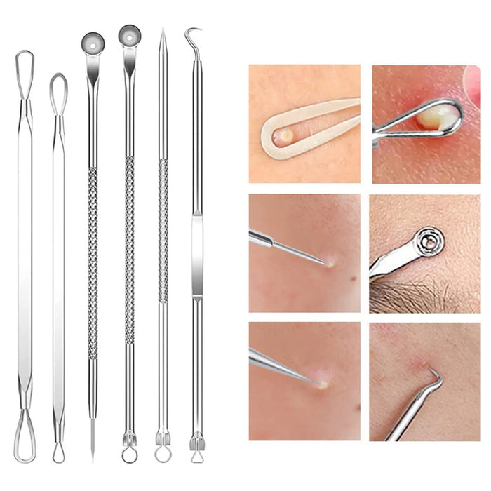 15Pcs  Stainless Steel Blackhead Remover Pimple Popper Tools Kit with Metal Case