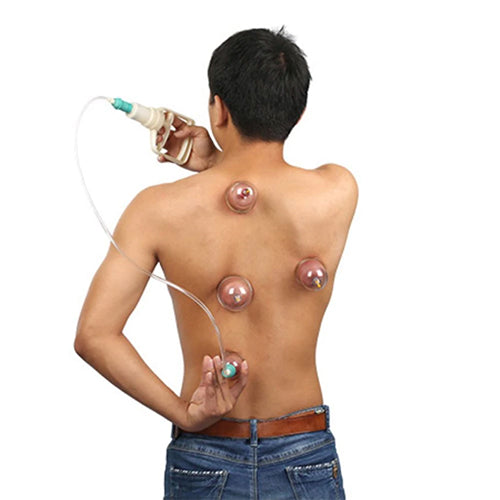 Therapy Suction Acupuncture With 12 Different Size Cups